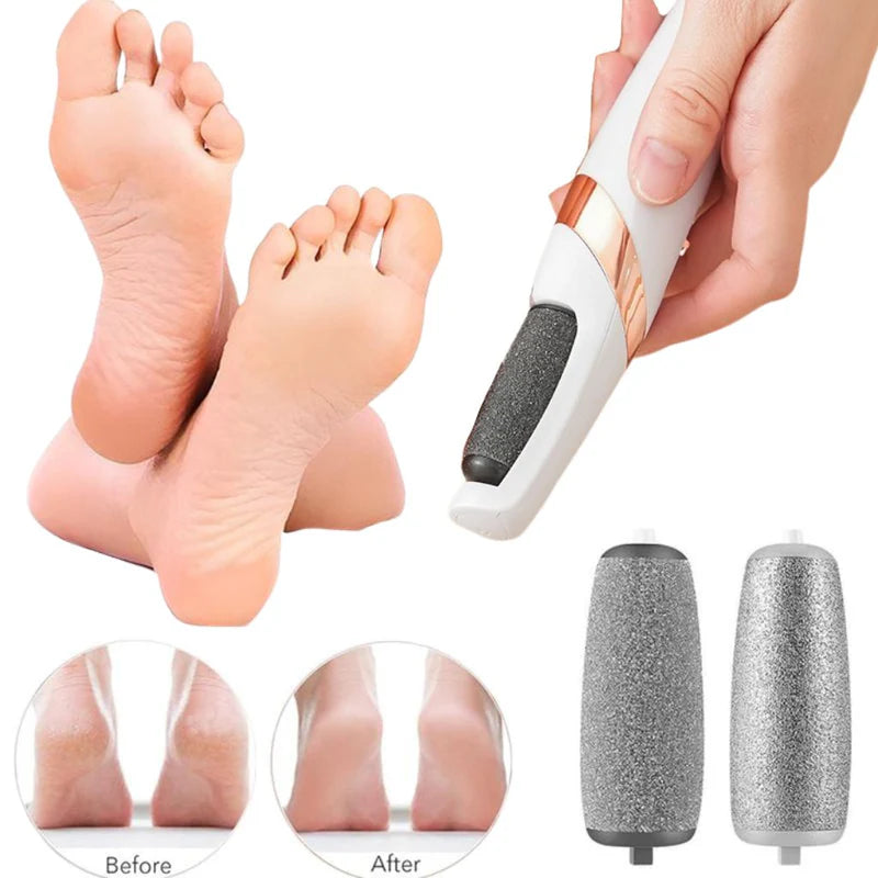 Electric Callus Remover